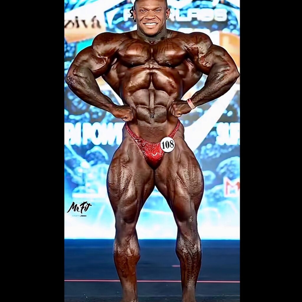 Tonio Burton - Gallery Image